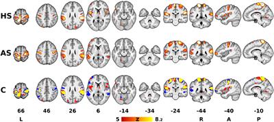 Differential Effects of Sustained Manual Pressure Stimulation According to Site of Action